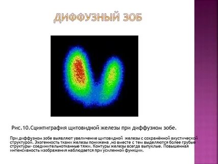 Стенография щитовидной железы
