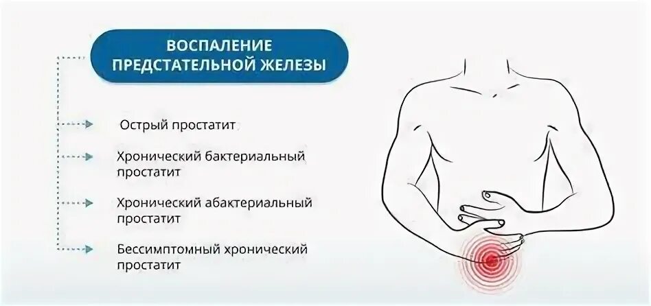 Симптомы простатита у мужчин в 50