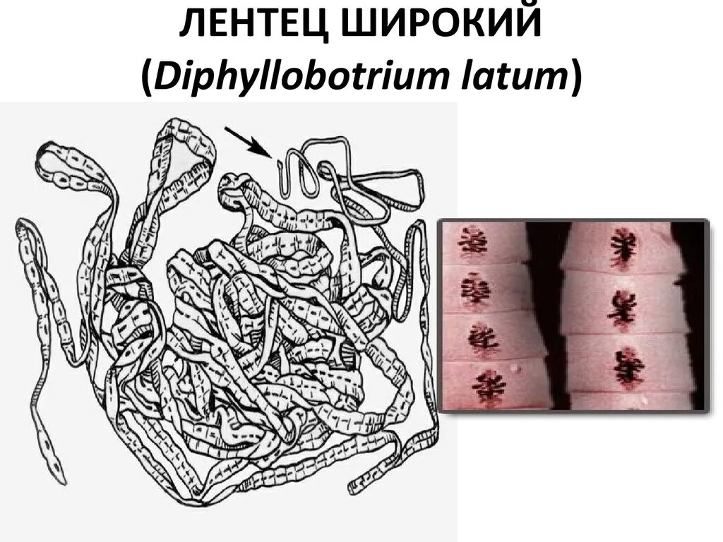 Червь широкий лентец. Широкий лентец строение рисунок. Широкий лентец паразит рыб. Широкий лентец (Diphyllobothrium latum).