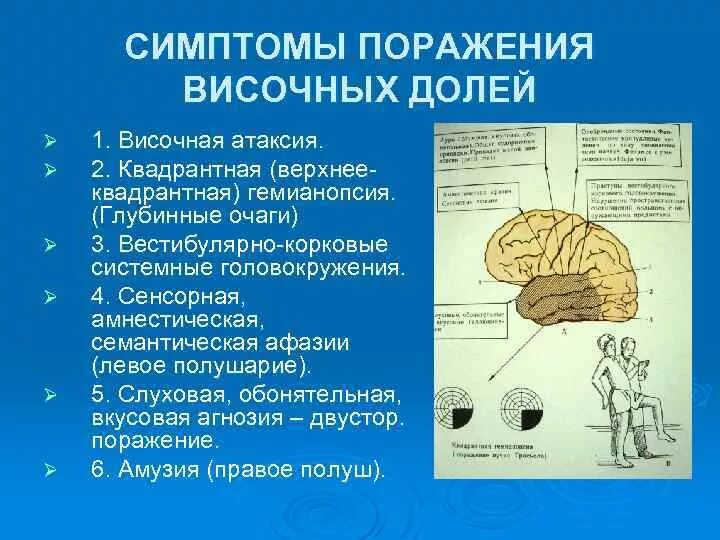 Поражения корково мозга. Симптомы поражения коры височной доли головного мозга. Симптомы поражения коры височной доли. При поражении левой височной доли. Поражение височной доли головного мозга симптомы.