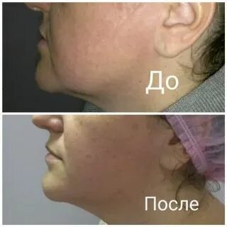 Кожный астрахань