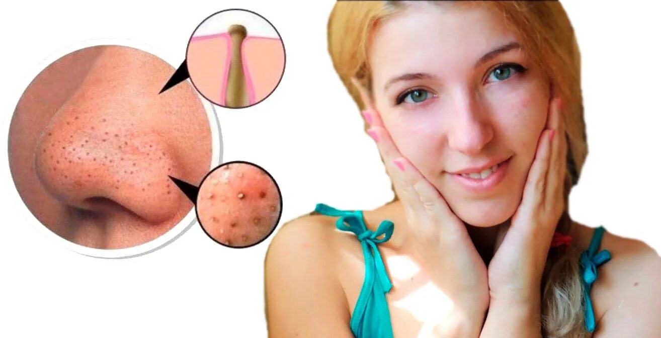 Нежная женщина. Пор ви. Пор ви. Черные точки возле губ. Картинки про любовь.