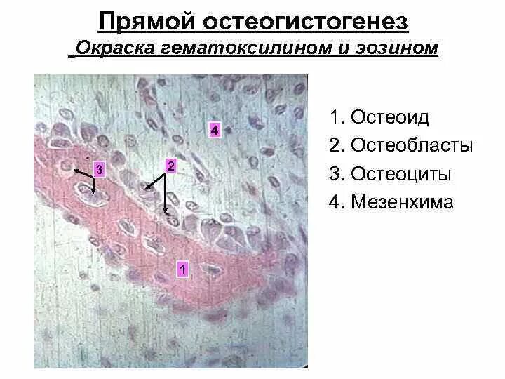 Прямой и непрямой остеогенез гистология. Остеокласт препарат гистология. остеоциты гистология препарат. препарат непрямого остеогенеза гистология. остеоциты гистология строение.