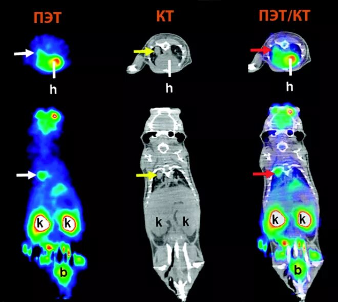 Позитронно-эмиссионная томография опухоли. Мрт, ПЭТ/кт, ОФЭКТ. Позитронно-эмиссионная томография снимки. Позитронно-эмиссионная томография ПЭТ/кт. Пэт кт или кт что лучше