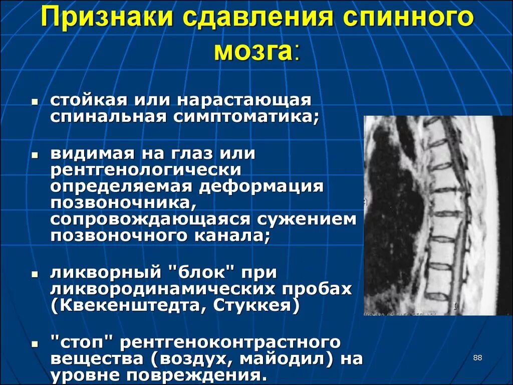 Сдавление спинного. Сдавление спинного мозга симптомы. Компрессия спинного мозга. Компрессия спинного мозга симптомы. Симптомы поражения спинного мозга.