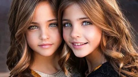 Conoce a Ava y Leah, las gemelas 'más bellas del mundo' .