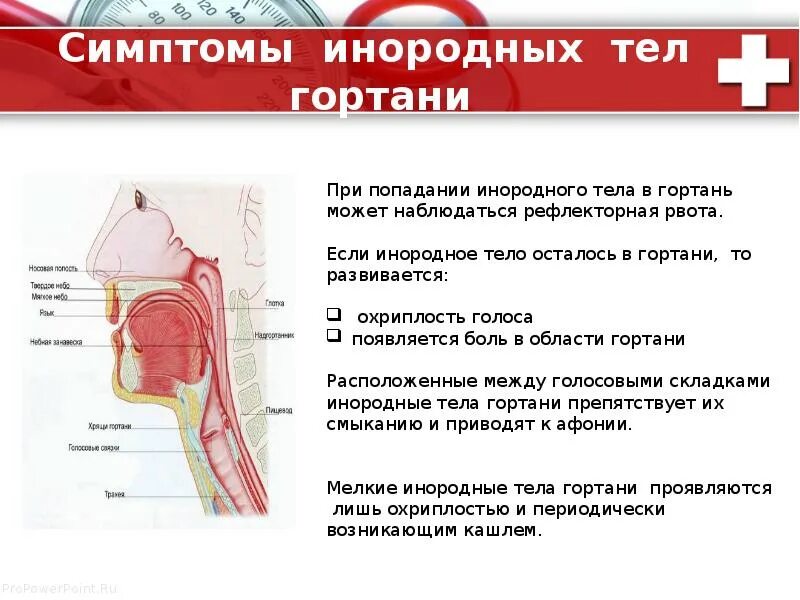 Болл в гортани при глотании. Чувство инородного тела в горле.