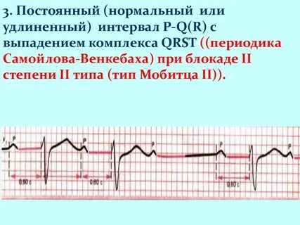 Выпадение комплекса