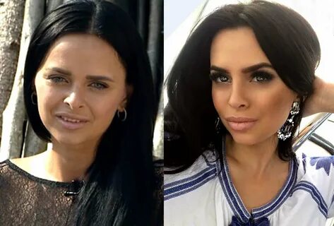 Давай после пластики