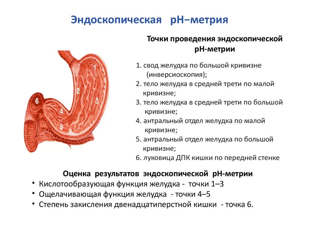 Ковид желудка. РН-метрия (исследование кислотообразующей функции желудка). РН-метрия желудка заключение. РН метрия при язвенной болезни желудка. Эндоскопическая внутрижелудочная РН-метрия.