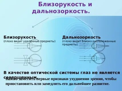1 это близорукость или дальнозоркость