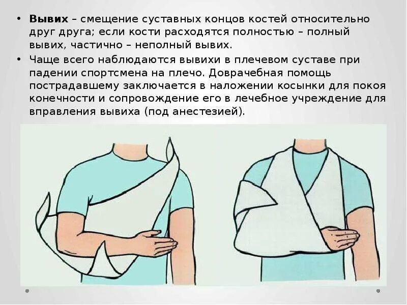 Вывих или растяжение плеча. Первая помощь при вывихе плеча. пмп при вывихе плечевого сустава. вывих плеча косыночная повязка. вывих плеча оказание первой помощи.