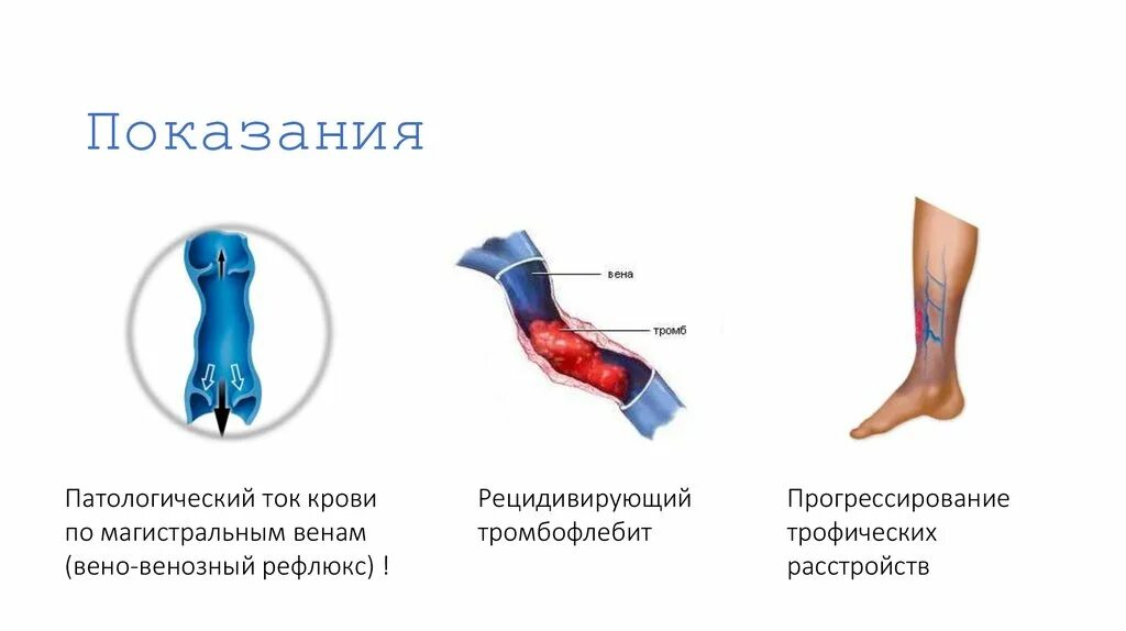 Тромбофлебит карта вызова. Заболевания вен нижних конечностей. Варикозная болезнь нижних конечностей. Хирургические заболевания вен нижних конечностей.