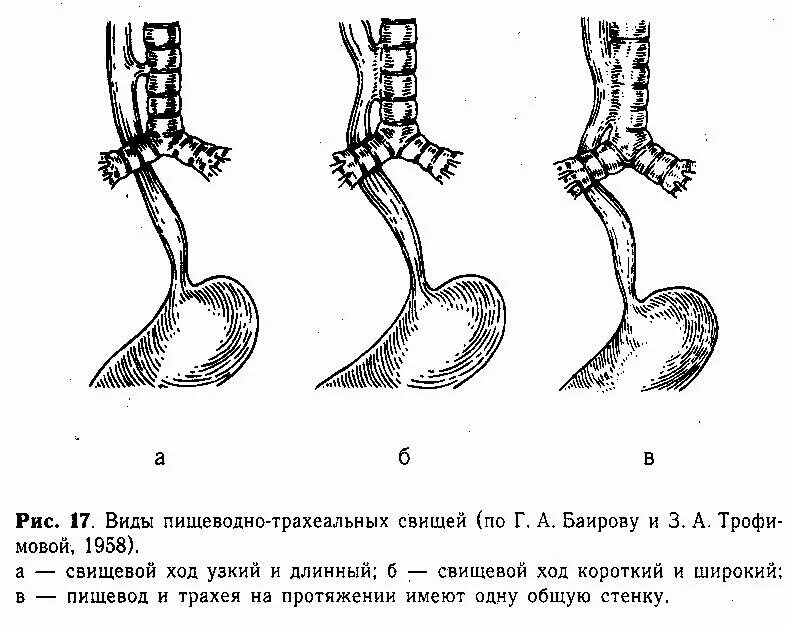 Форма пищевода