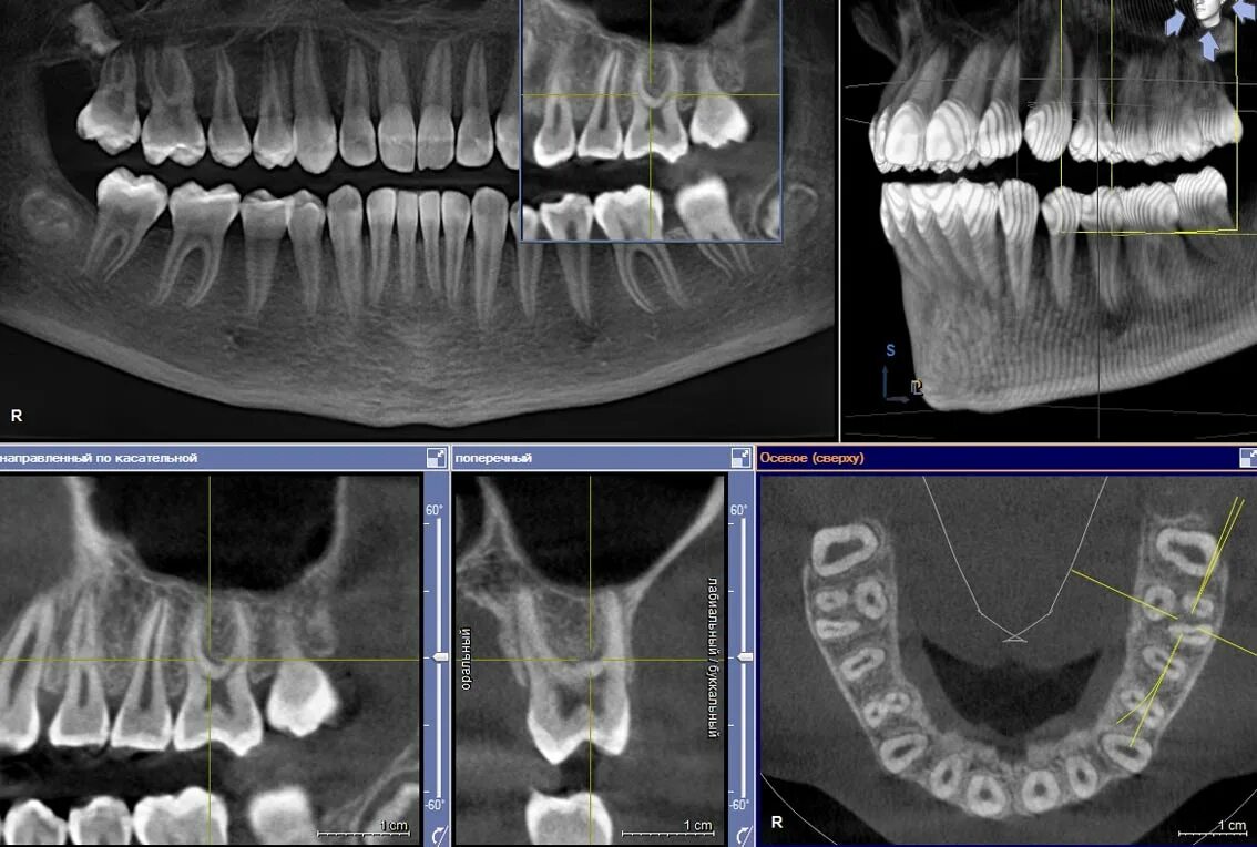 Где сделать кт зуба. Кт 3д зубочелюстной системы. 3d снимок кт зубов Михайловск. 3д рентген зубов Ташкента.
