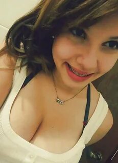 Braces and big boobs