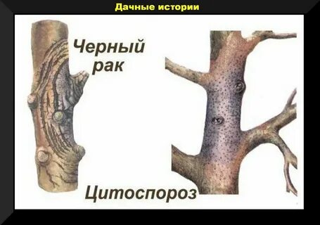 Лечение черного рака