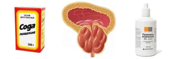 Простатит перекись. Неумывакин аденома предстательной железы. Перекись от простатита. Сода пищевая для простатита. Перекись водорода от простатита.