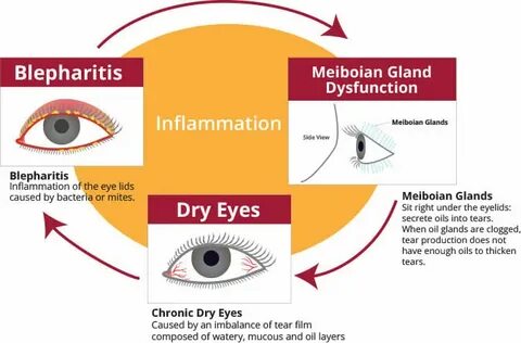 Blepharitis латынь
