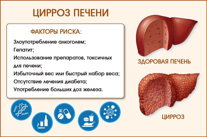 Гепатит на сколько лет. Заболевание цирроз печени. Печень здоровая и больная.