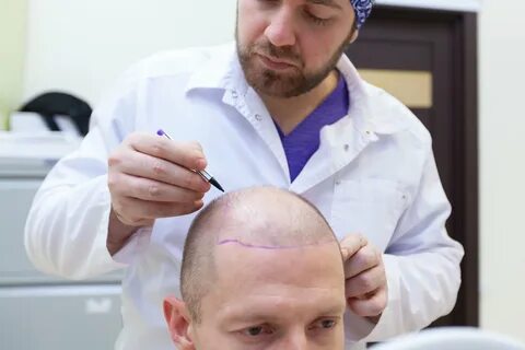 Hair Transplant Cost: How Much Do They Really Cost? 