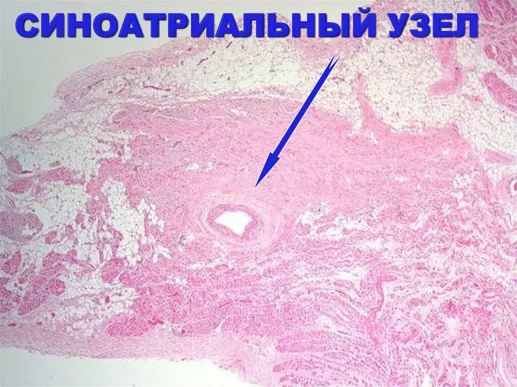 Сердечная система гистология. Волокна пуркинье в сердце гистология. клетки пуркинье гистология препарат. кардиомиоциты проводящей системы сердца гистология.