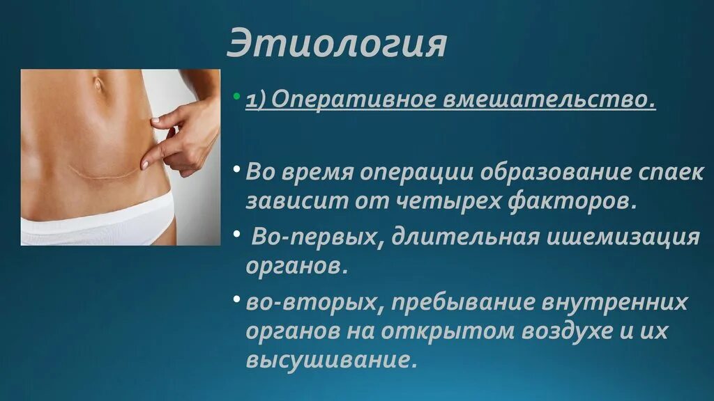 Препарат кесарево. Спаечная болезнь этиология. Осложнения спаечной болезни. Патогенез спаечной болезни брюшной полости. Спаечная болезнь презентация.