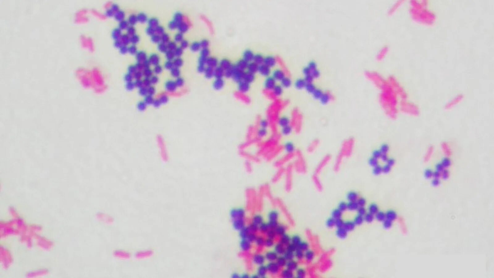 Туберкулез кокки. Candida albicans грамположительные. Escherichia coli микроскопия. Escherichia coli по Граму. Микробиология микроскопия по грамму.