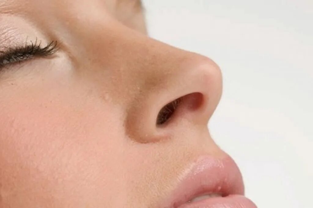 рассказ носова телефон. розовый нос у подростка. нос картинка. н ноздри. человеческий нос.