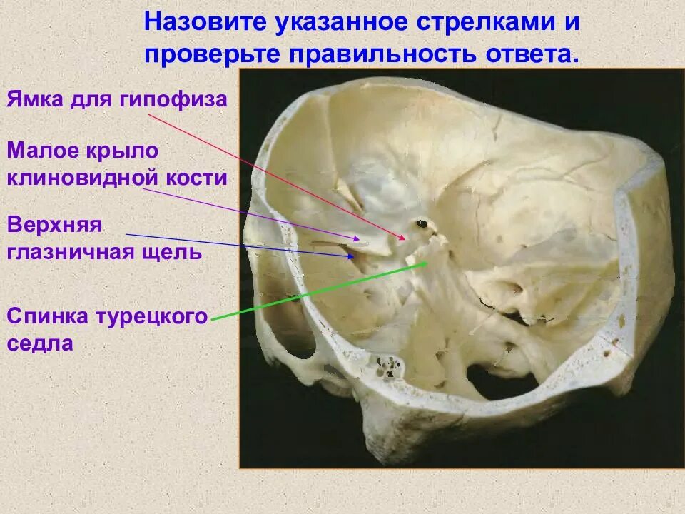 Турецкие седло кость. Клиновидная кость черепа турецкое седло. Гипофизарная ямка турецкого седла клиновидной кости. Ямка турецкого седла клиновидной кости. Верхняя глазничная щель клиновидной кости.