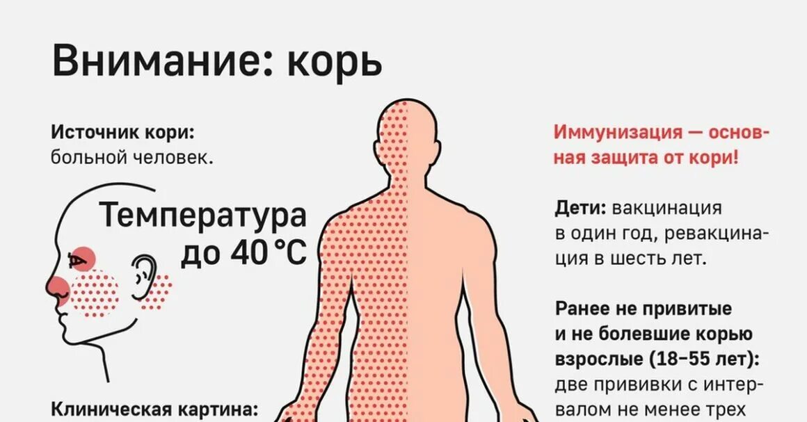 Осложнения при иммунизации против кори. Осложнения после коревой вакцины. Вакцинация и ревакцинация против кори. Корь 2024. Памятка по кори.