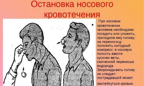 При носовом кровотечении необходимо выполнить. Причины носового кровотечения. Остановка носового кровотечения. При кровотечении из носа. Причины кровотечения из носа.