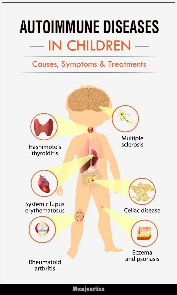 Autoimmune disease. Авто иммунное заболевание что такое. Аутоиммунный протокол. Autoimmune disease. Аутоиммунный образ жизни.