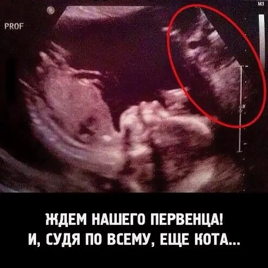 Рентген сердца Funny cats, Kittens funny, Cat memes