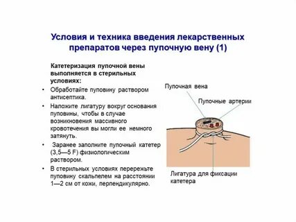 Асфиксия мозга