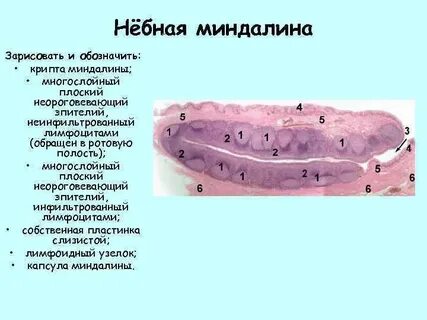 Эпителий небной миндалины