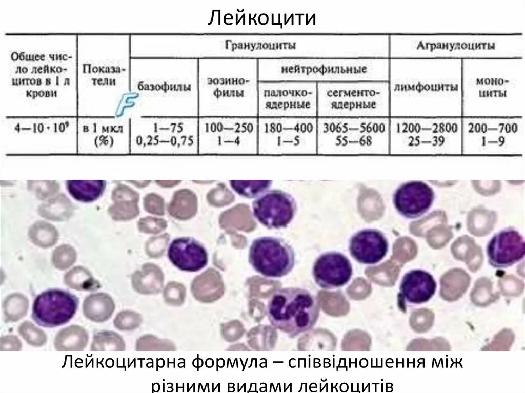 Лейкоцитарная реакция в мазке что это. Лейкоцитарная формула лимфоциты. Клетки крови лейкоцитарная формула. Лейкоцитарная формула крови микроскопия. Мазки крови на лейкоцитарную формулу.