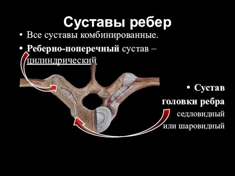 Реберная братск. Связки реберно поперечного сустава. Позвоночно-реберный сустав строение. Сустав головки ребра и реберно поперечный сустав. Рёбернорозвоносные суставы.