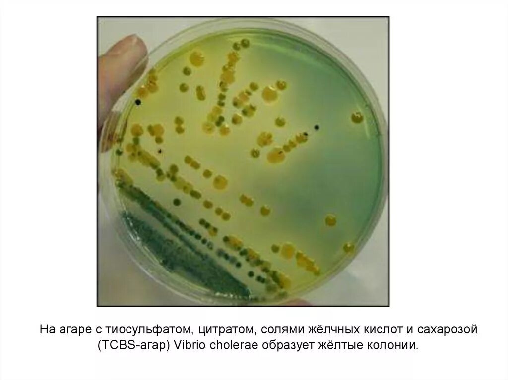 Холера питательные среды. Холерный вибрион на питательных средах. Холерный вибрион колонии на МПА. Холерный вибрион рост на питательных средах. Колонии холерного вибриона на щелочном агаре.