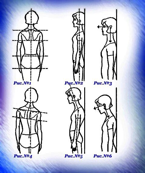 Вертикальное положение тела. Осанка эскиз. Рисунки из осанки. Как нарисовать осанку. Смешной рисунок исправление осанки.