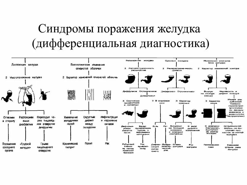 Синдромы при заболеваниях жкт. Рентгенологические синдромы патологии жкт. алгоритм дифференциальной рентгенодиагностики болезней. основные рентгенологические синдромы заболеваний жкт. синдромы заболеваний жкт лучевая диагностика.