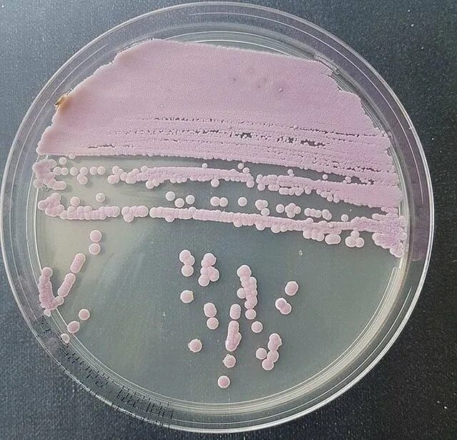 Молочница бактерии. Кандида грибок микробиология. Candida SPP микробиология. Колонии грибы рода кандида микробиология.