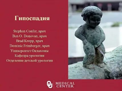 Гипоспадия это