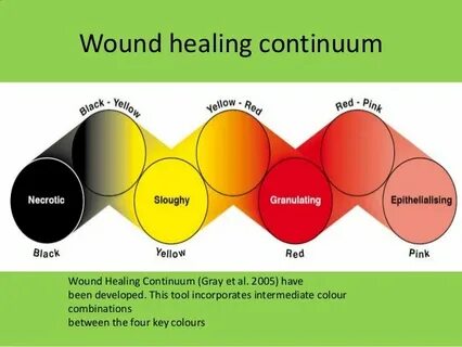 Wound healing