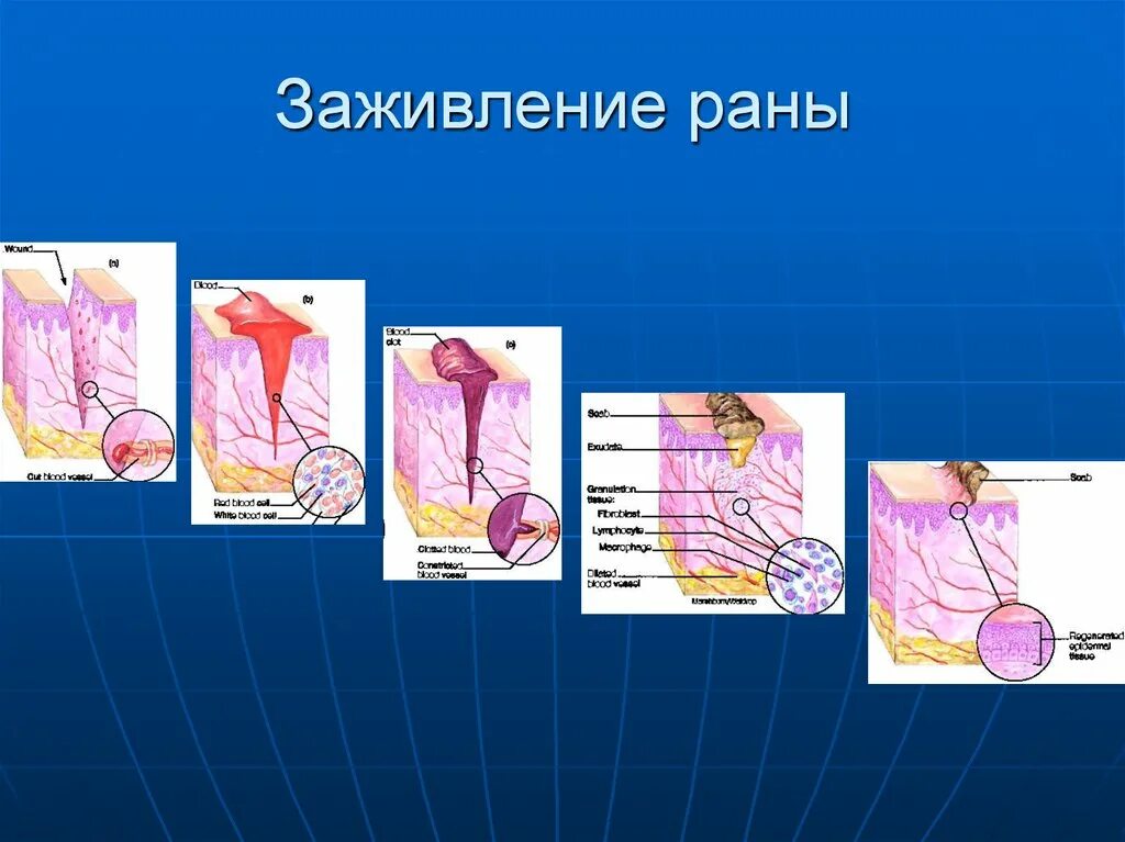 Этапы заживления ран. Заживление РАН. Фазы заживления РАН. Процесс заживания раны. Период заживления раны.