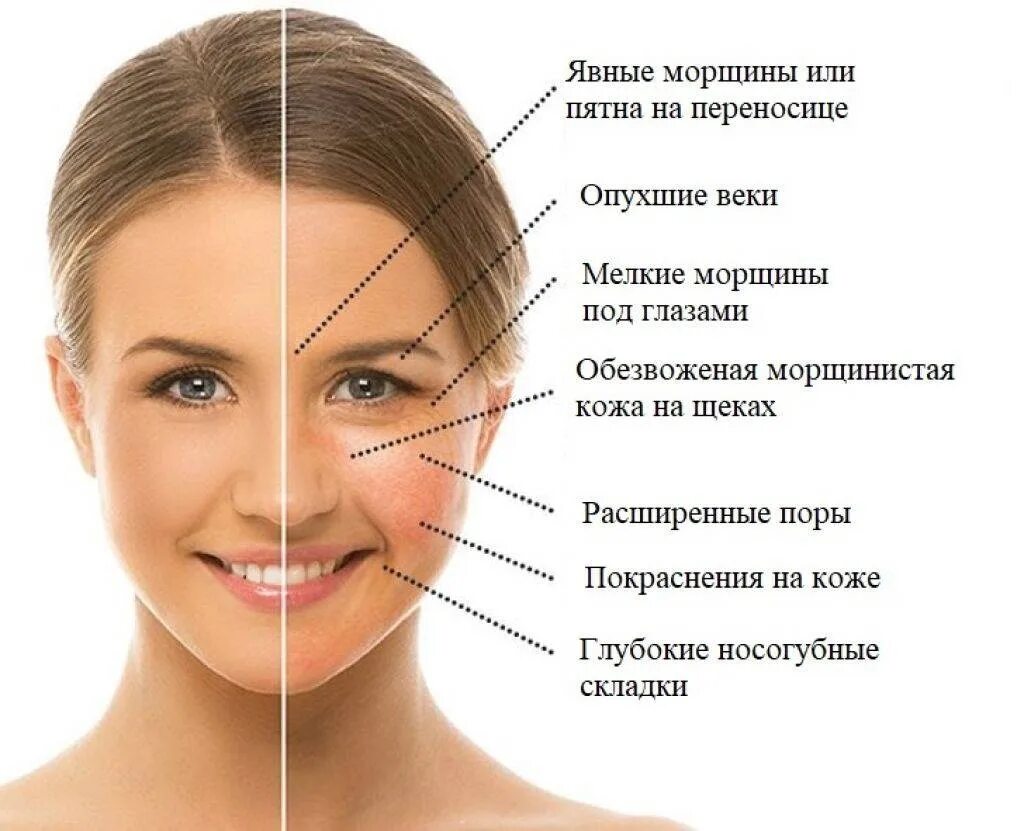 Чувствую щеки