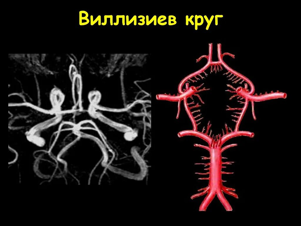 Артерии круг головного мозга. Сосуды виллизиевого круга мрт. Артерии головного мозга Виллизиев круг схема. Кровоснабжение головного мозга схема Виллизиев круг. Соединительные артерии Виллизиева круга.