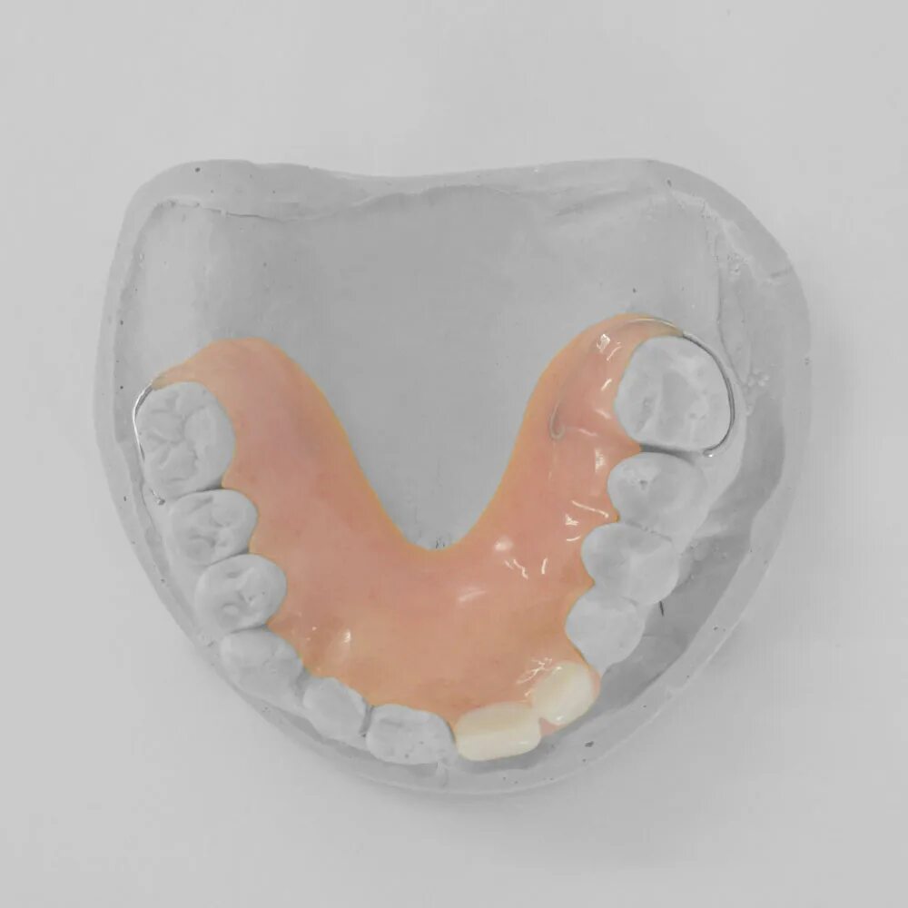 Частичный съемный протез Flexi n512. Мягкие зубные протезы флекси. Полный съемный нейлоновый протез Flexi nylon.