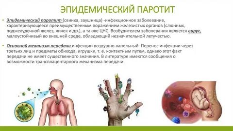 Паротит сыпь