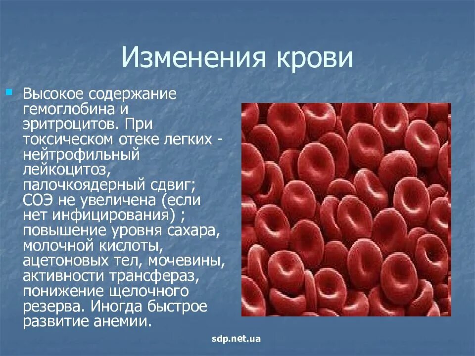 Какая болезнь при гемоглобине. Эритроциты. Эритроциты в крови. Высокий гемоглобин и высокие эритроциты. Повышение количества эритроцитов.